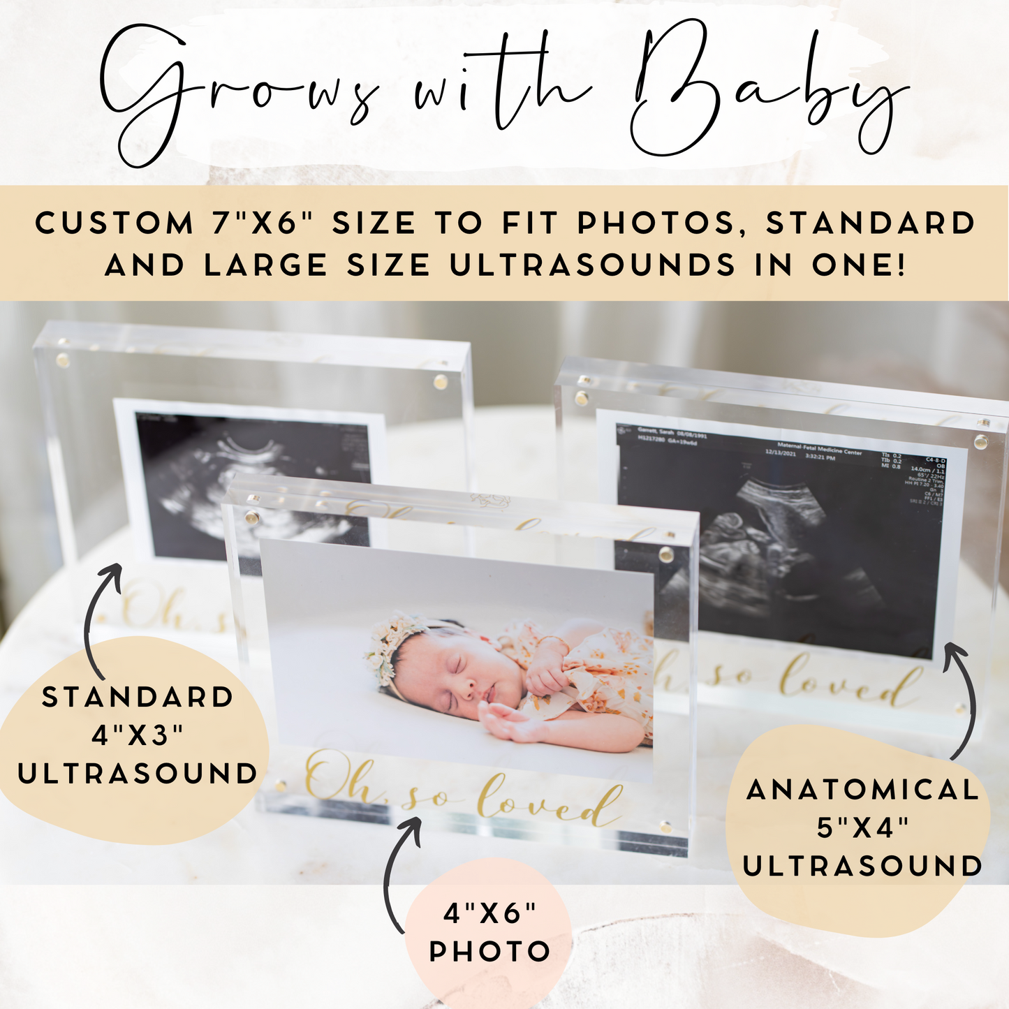 Ultrasound Picture Frames